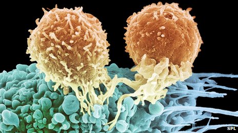 T-cells killing cancer (http://www.bbc.com/news/health-20898931)